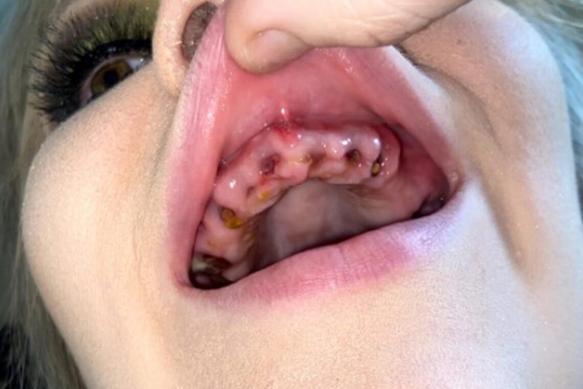 My teeth and hair fell out when my health plummeted My teeth and hair fell out when my health plummeted