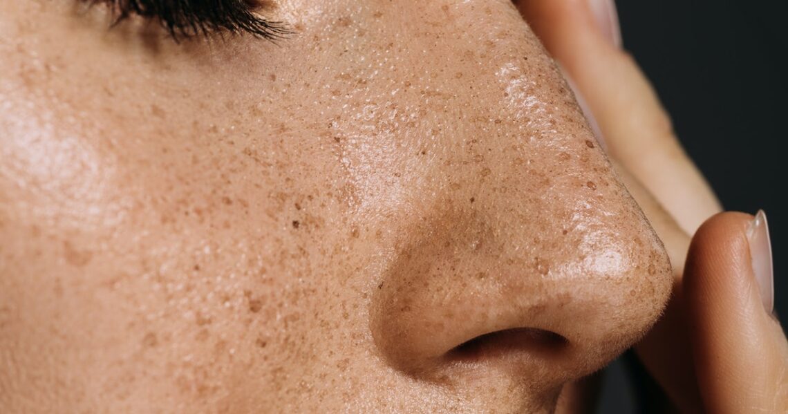 Tattooed Faux Freckles Are Trending on TikTok