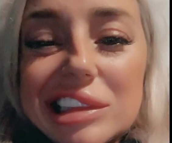 I went to Turkey to get veneers but came back and half my face was paralysed I went to Turkey to get veneers but came back and half my face was paralysed