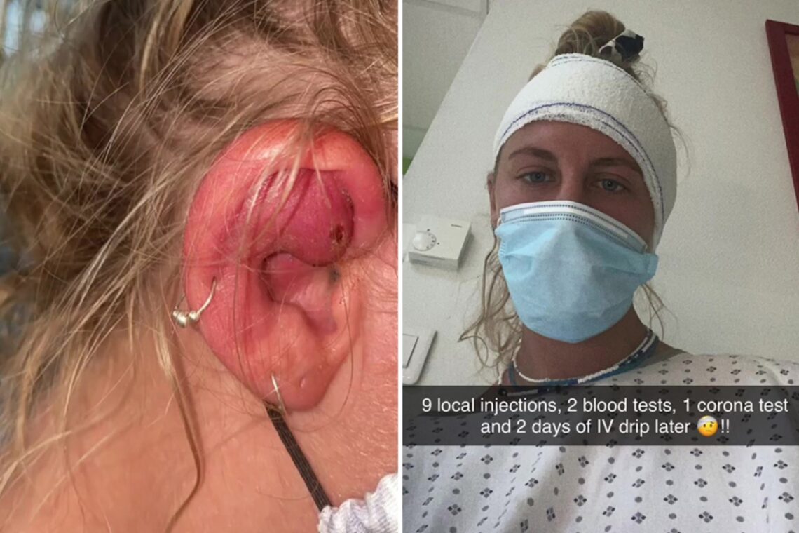 I spent 6 weeks in a foreign hospital after getting my ear pierced – it got infected so badly I had to have surgery