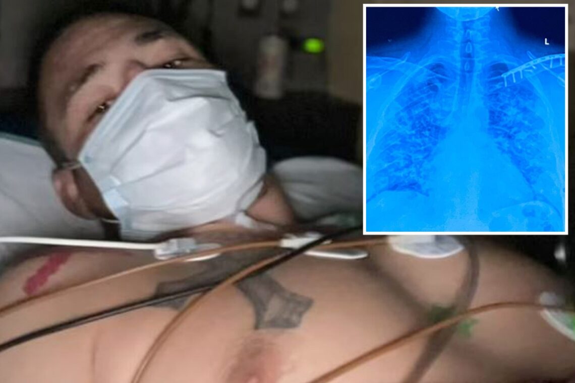 UFC’s Diego Sanchez in hospital with blood clots and pneumonia after refusing vaccine