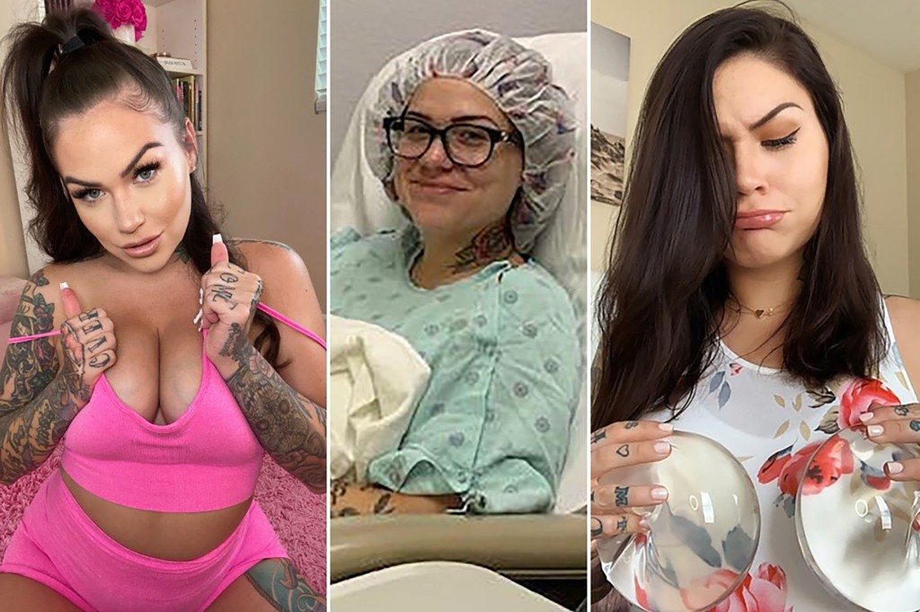 OnlyFans star: ‘My fake breasts poisoned me and I thought I was dying’