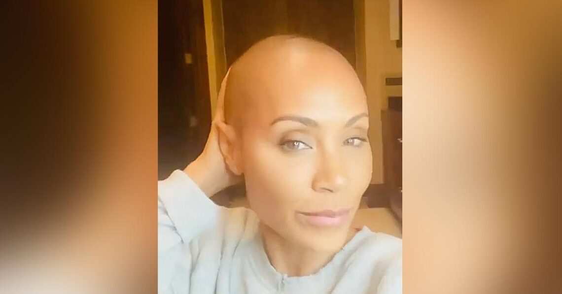 Jada Pinkett Smith Shares Struggle With Alopecia In Vulnerable New Clip: ‘At This Point I Can Only Laugh’