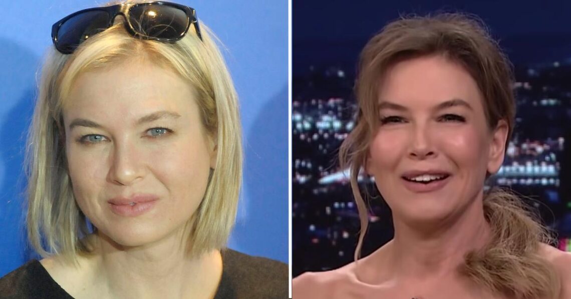 Renée Zellweger Debuts Fresh Tight Face, Plastic Surgeons Weigh In