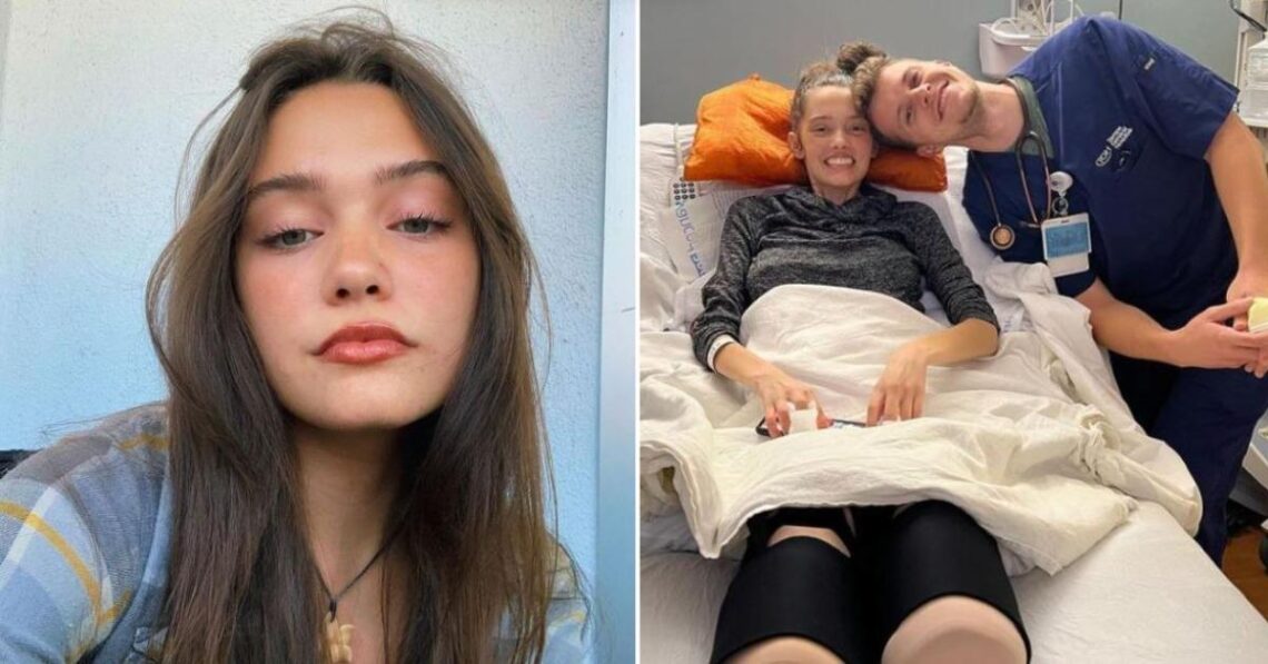 21-Year-Old Model Loses Both Her Legs After COVID-19 Complications