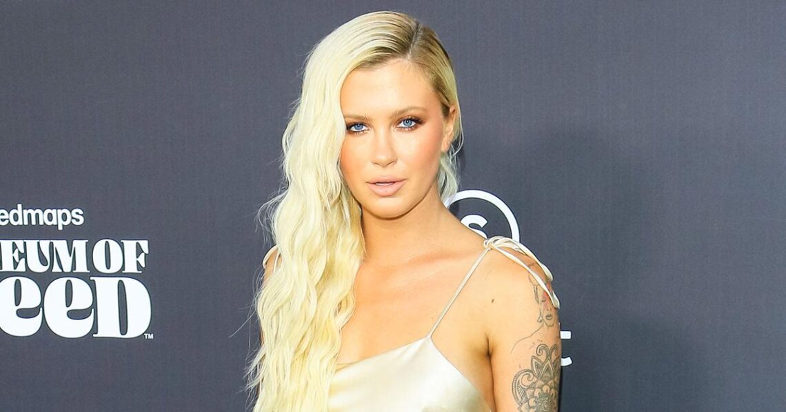 Alec Baldwin’s 26-Year-Old Daughter Ireland Catches Heat After Revealing She’s Recovering From ‘Mini Facelift’