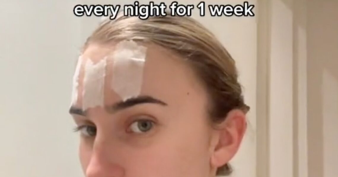Face Taping is TikTok’s Most Recent Questionable Skin Care Hack