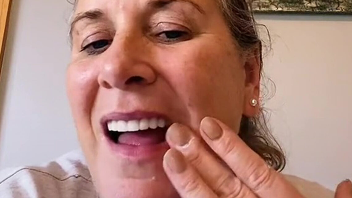 I travelled to Turkey to get my teeth done – it was the biggest mistake of my life