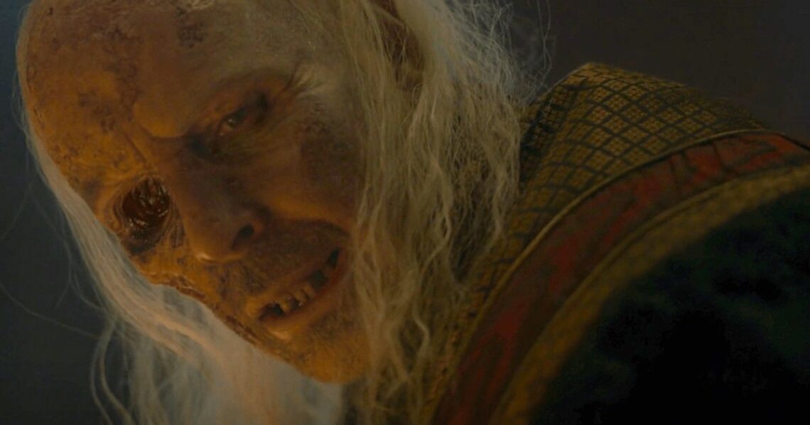 ‘House Of The Dragon’ Prosthetics Guru Studied Flesh-Eating Diseases For Viserys