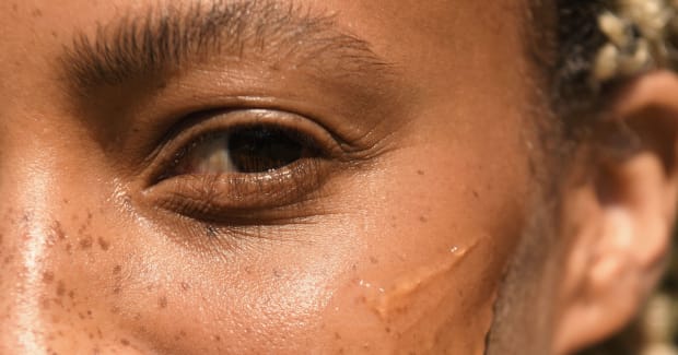 Dermatologists Swear By This $9 Drugstore Cleanser to Treat Acne