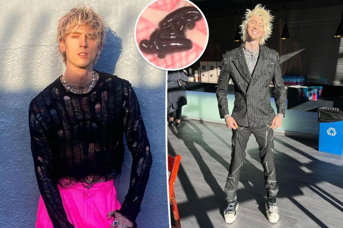 Machine Gun Kelly has leeches crawl on his stomach: ‘My best friends’